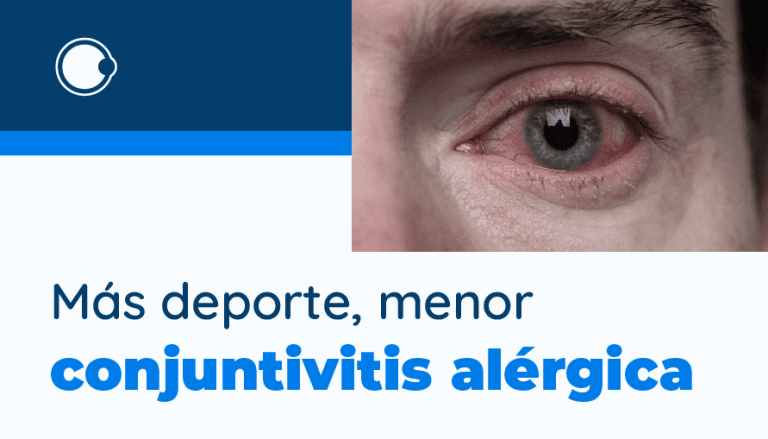 Más deporte, menor conjuntivitis alérgica.