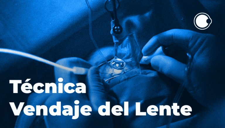 técnica del vendaje del lente