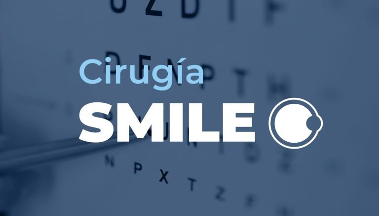 ¿Qué es la cirugía refractiva “SMILE”?