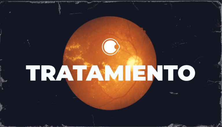 ¿Qué es lo nuevo en el tratamiento para atrofia geográfica?