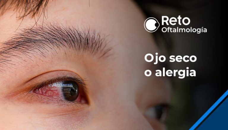 ¿Diagnosticar ojo seco o alergia?
