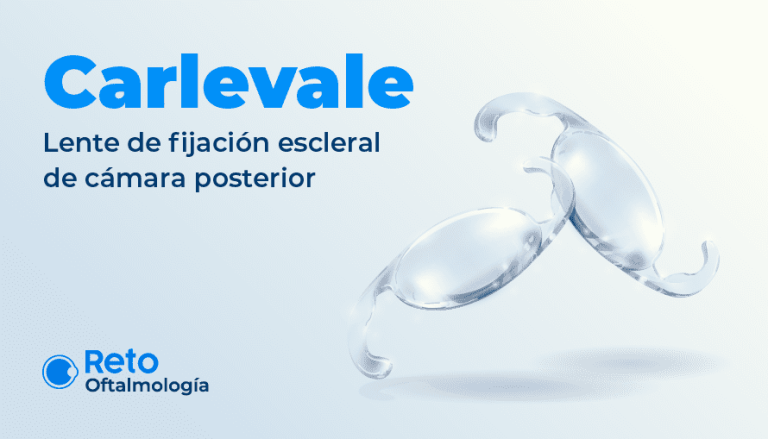¿Qué tanto sabes del lente de fijación escleral de cámara posterior Carlevale?