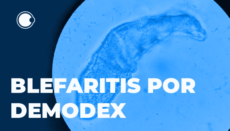 LA FDA APRUEBA LA PRIMERA TERAPIA (Xdemvy) PARA LA BLEFARITIS POR DEMODEX