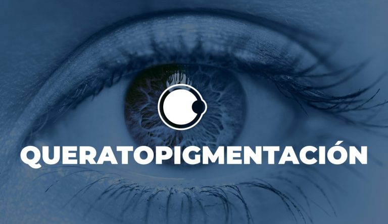Queratopigmentacion, ¿Un lujo o un riesgo?