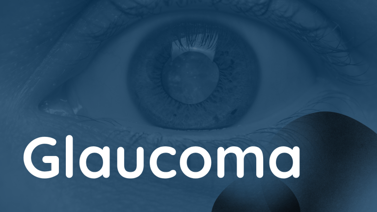 Glaucoma: la amenaza invisible y la promesa de la innovación