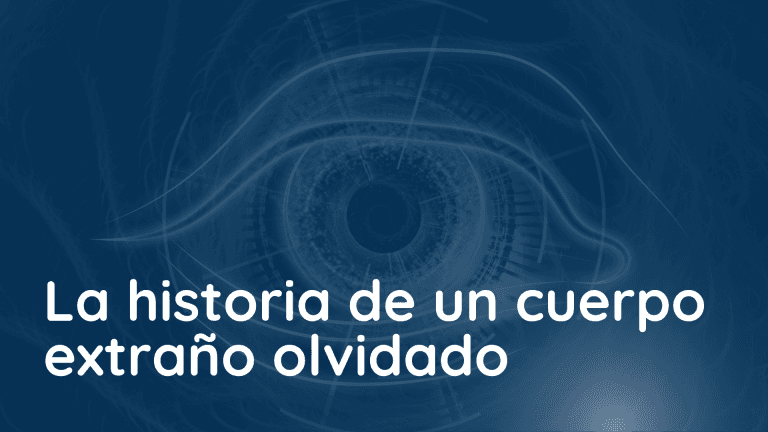Un viaje ocular inesperado: cuando un cuerpo extraño metálico se mantiene asintomático por más de 50 Años