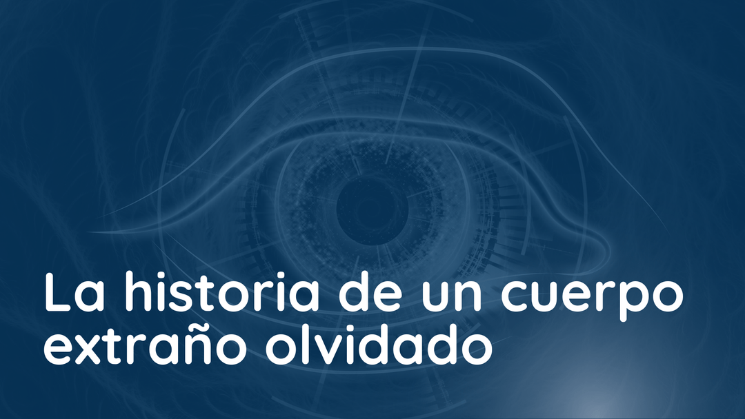 Un viaje ocular inesperado: cuando un cuerpo extraño metálico se mantiene asintomático por más de 50 Años