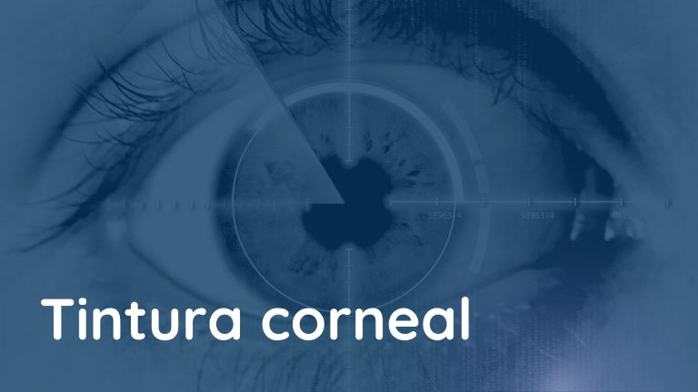 La tintura corneal: un punto de referencia clínico significativo en la enfermedad del ojo seco