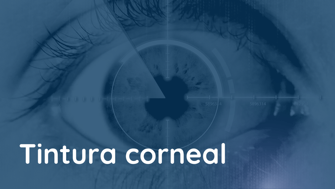 La tintura corneal: un punto de referencia clínico significativo en la enfermedad del ojo seco